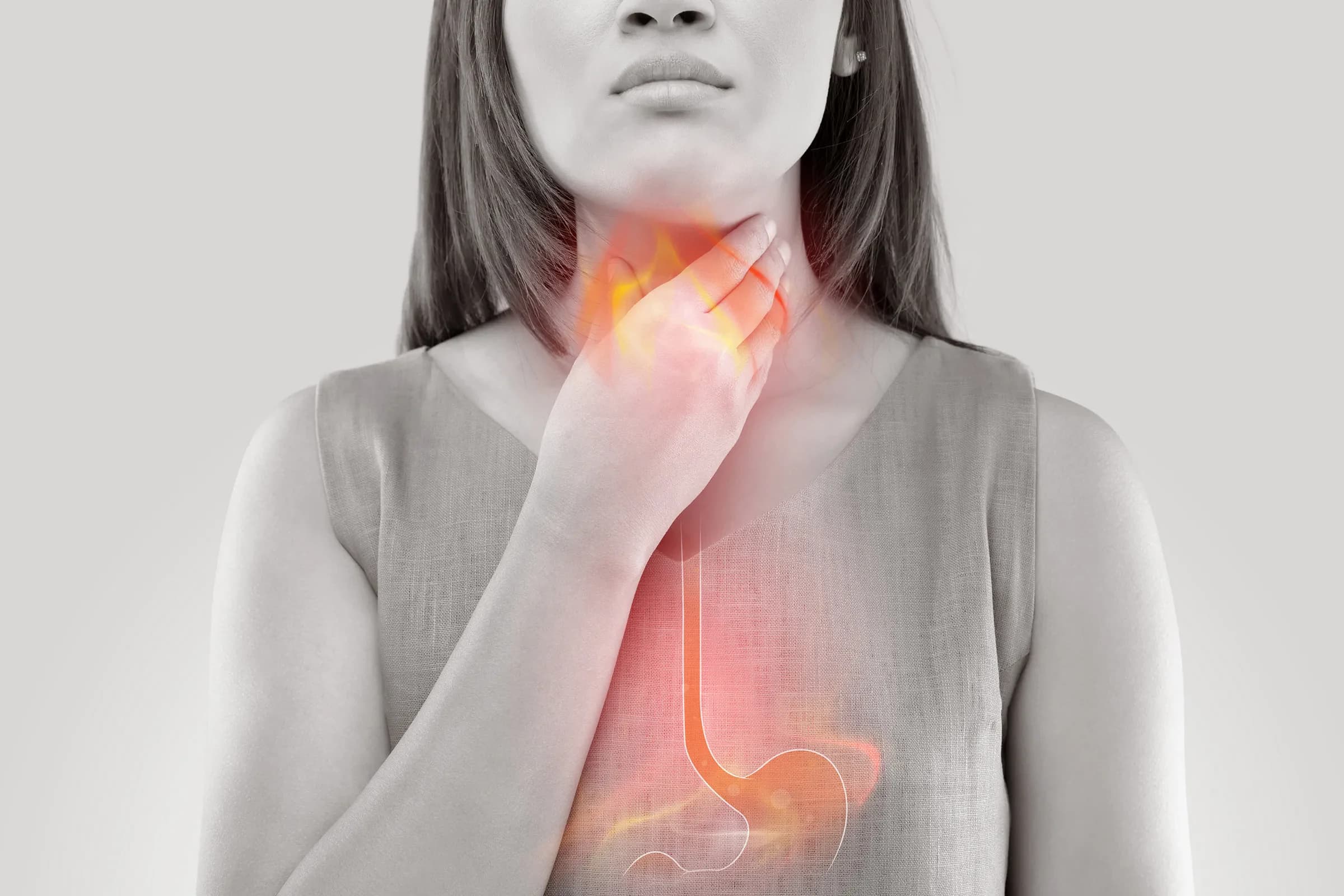 ### **Acid reflux:** 

 ## Symptoms, Causes, Tests And What Actually Works