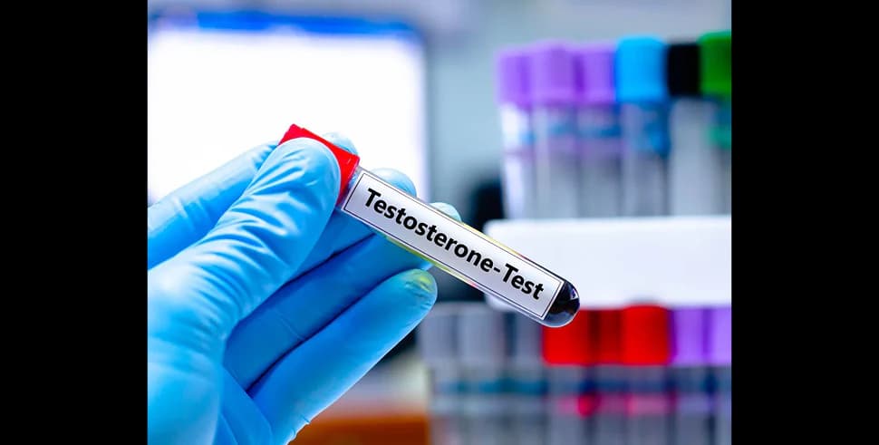 How low testosterone is diagnosed