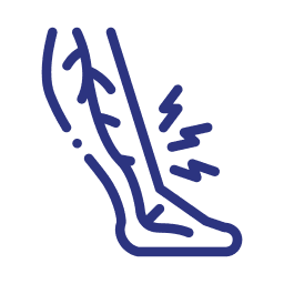 Varicose Veins
