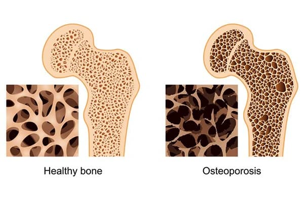 what happens to your muscle during menopause