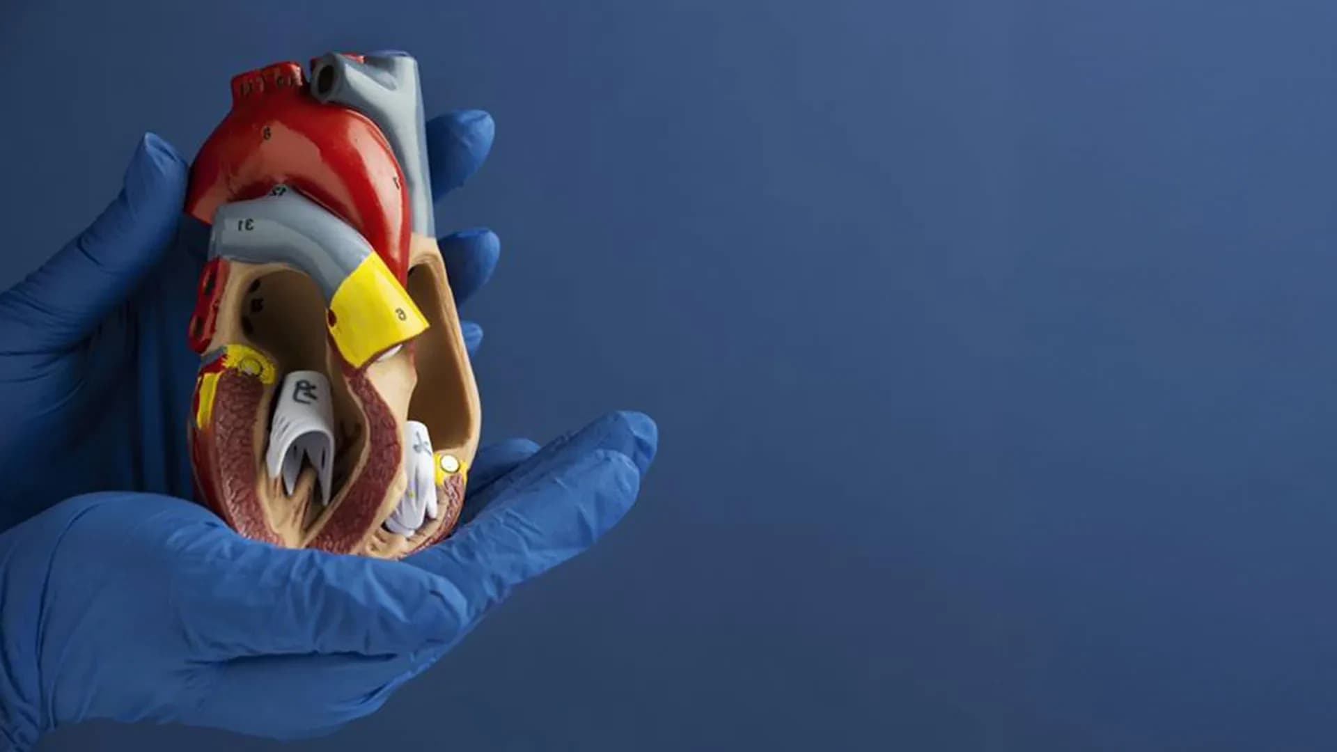 Cardiac Screening at LIPS Healthcare