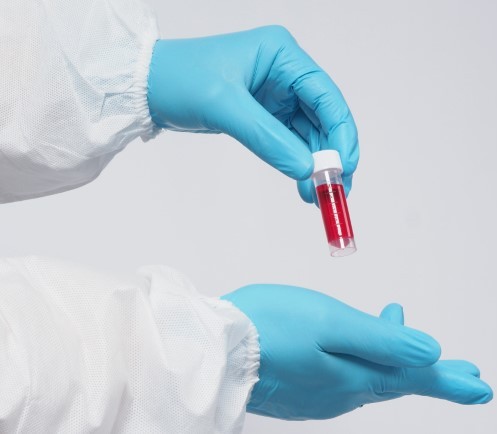Blood Test