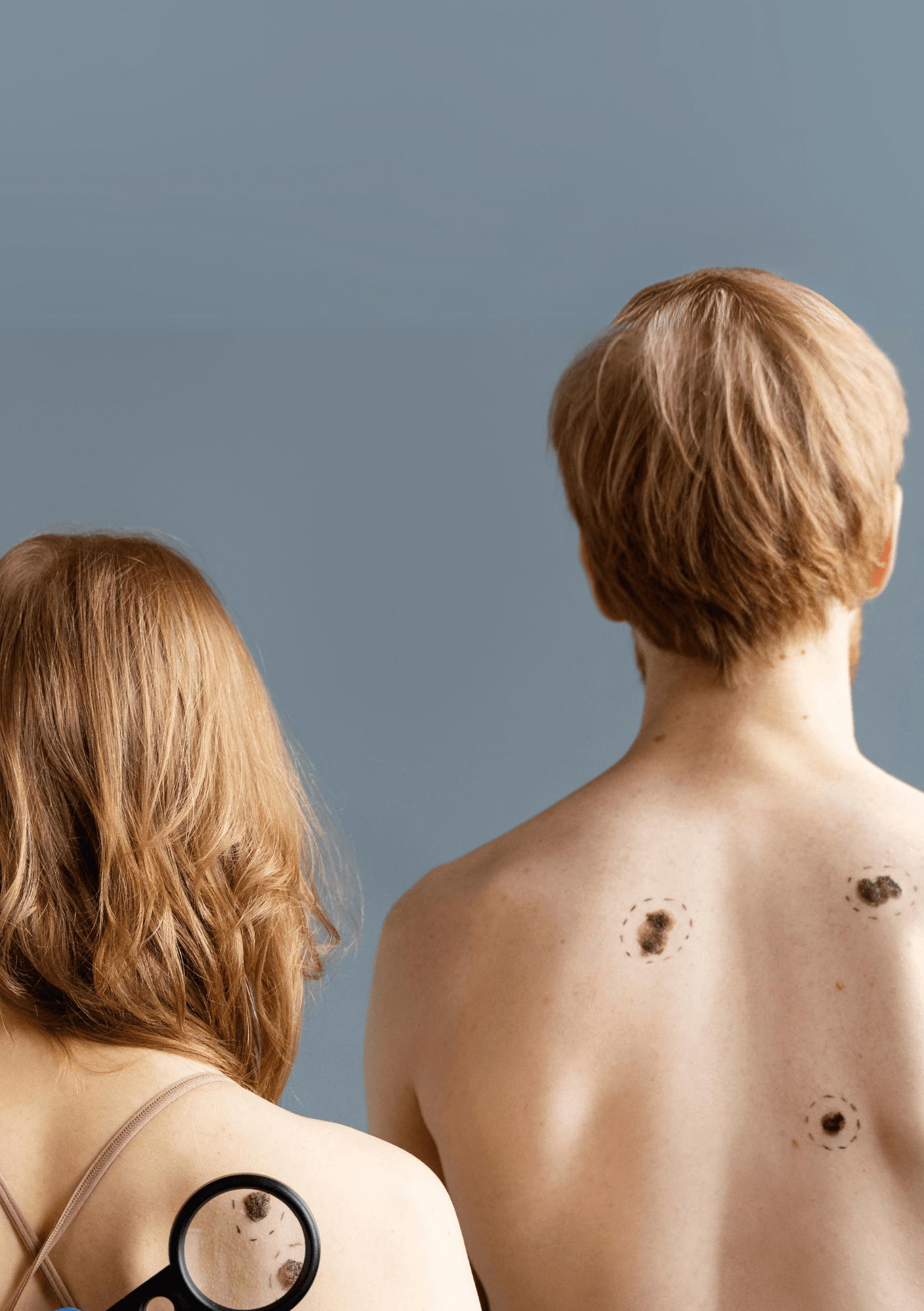 Skin Cancer