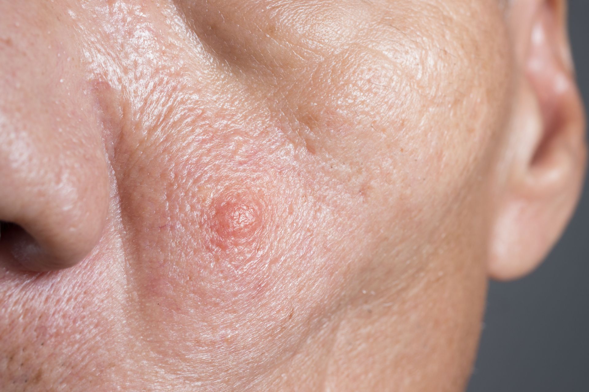 carcinoma-complications-1-mobile