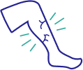 Varicose Veins