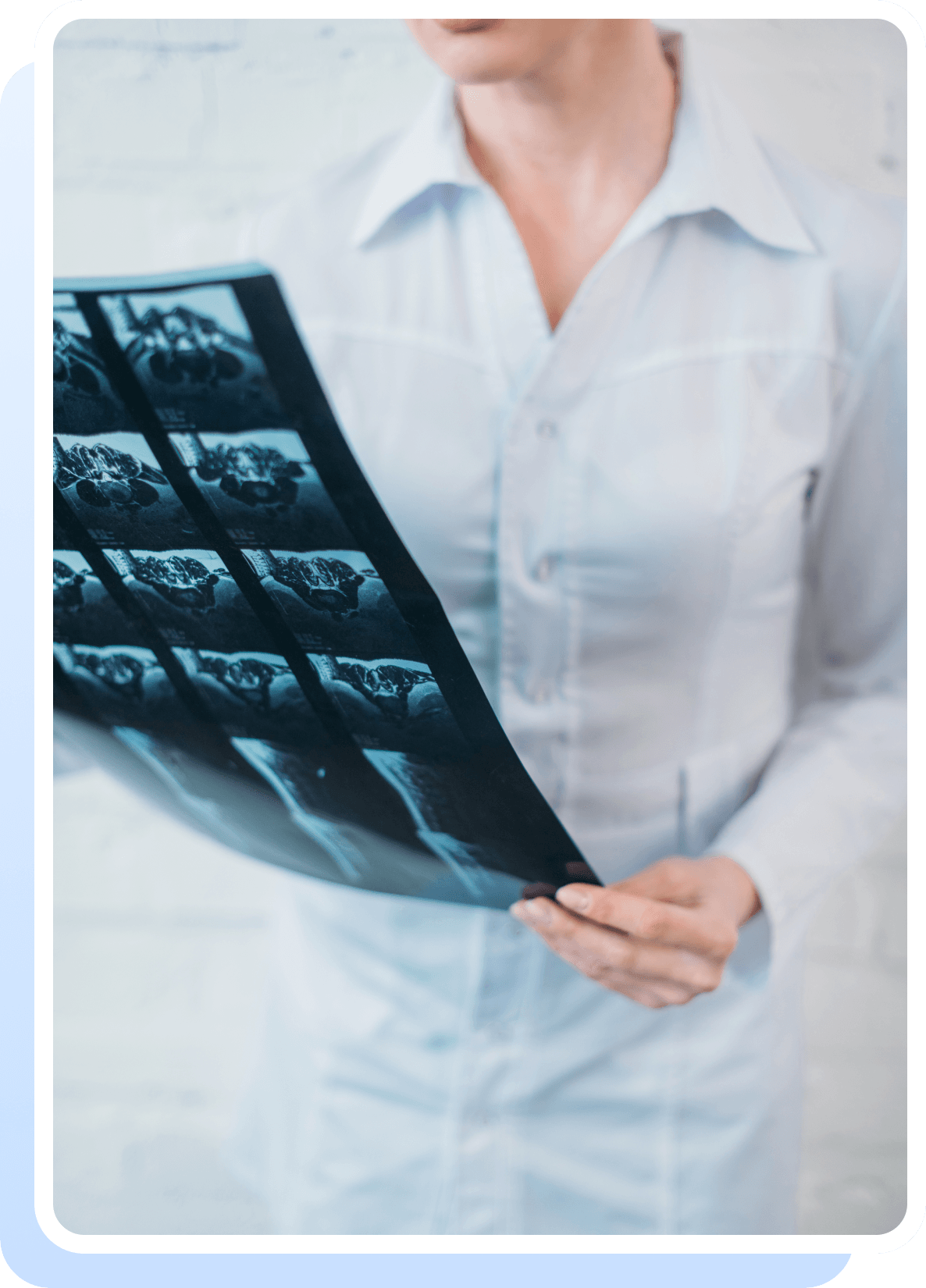 diagnosing-osteoporosis