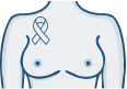 A family history of breast cancer or known genetic risk factors (e.g. BRCA mutations).
