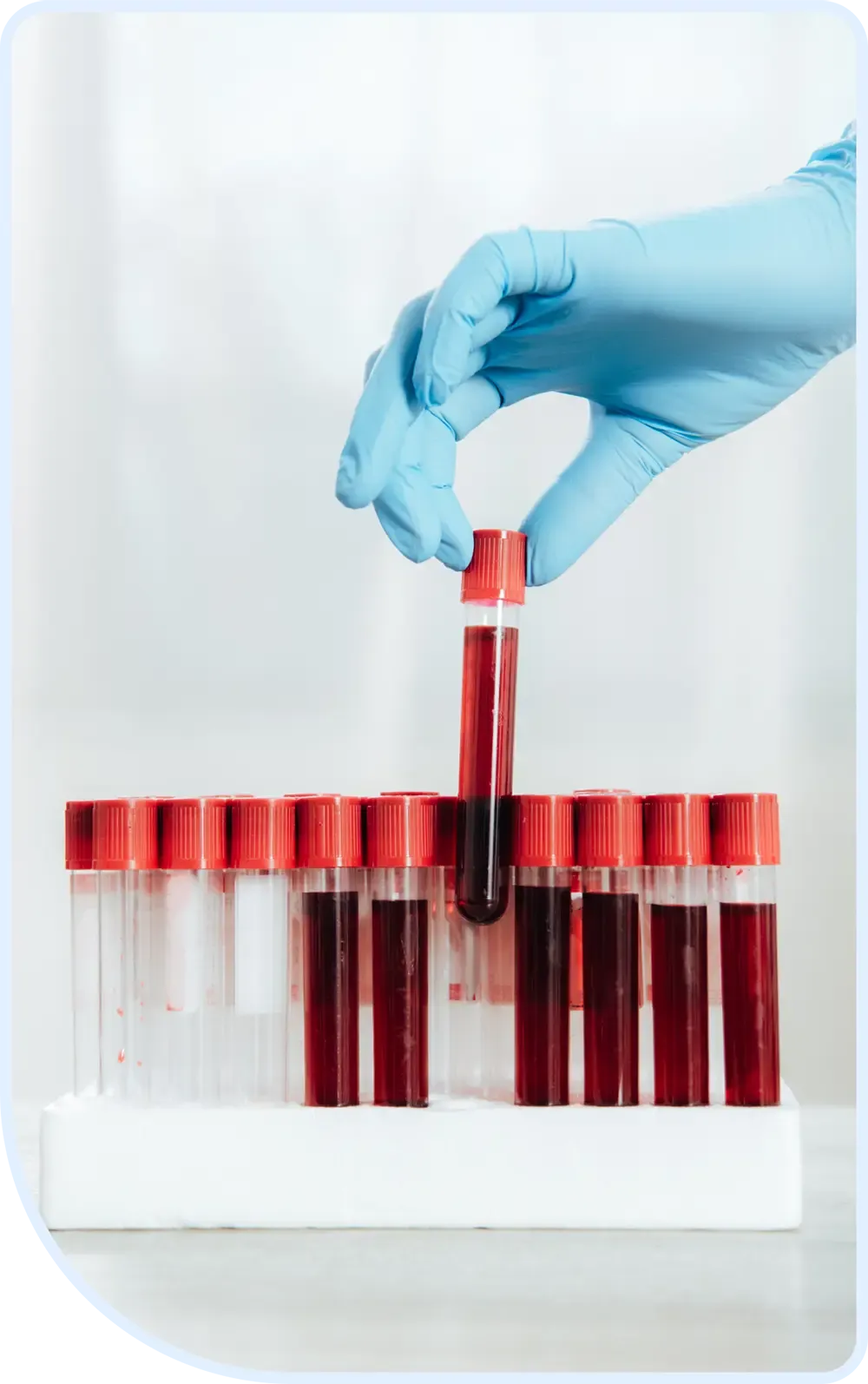 albumin-levels