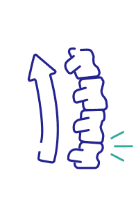 Sciatica
